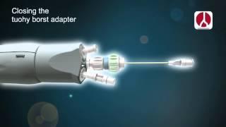 JOTEC - E-liac Stent Graft System