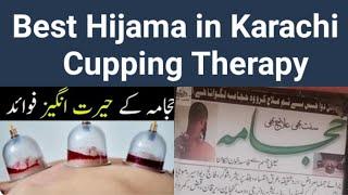 Best Hijama In Karachi Cupping Therapy