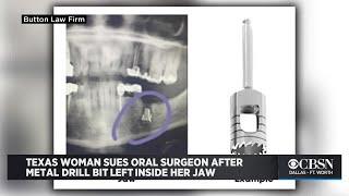 Texas Woman Sues Oral Surgeon After Metal Drill Bit Left Inside Her Jaw