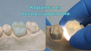 Безметалловая коронка, вкладка, виниры, мосты из оксида циркония | стоматология Самара