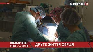 Чаклували над серцем 13 годин: волинські хірурги врятували пацієнтку з рідкісною патологією