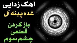 چشم سوم : باز کردن قطعی چشم سوم توسط آهک زدایی غده پینه آل