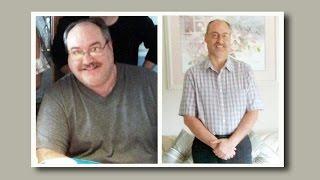 Changes and benefits after gastric sleeve surgery