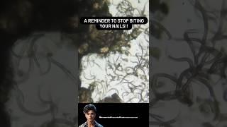 Nails Germs Under Microscope |  Nails Germs  #shorts #ytshorts #microscopeview