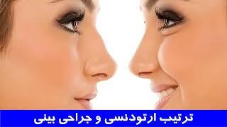 ترتیب ارتودنسی و جراحی بینی | دکتر احسان مهریزی