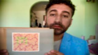 ASMR: Sight Impaired Cranial Nerve Exam (roleplay)
