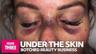 Under The Skin: The Botched Beauty Business | BBC Three