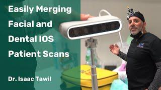 Easily Merging Facial and Dental IOS Patient Scans: Shining 3D Technology