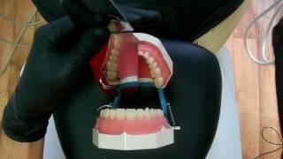 DentalПлюшки 25 - работа в зеркало