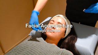 Regis Wellness TCM Facial Acupuncture