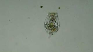 An amazing juggling rotifer