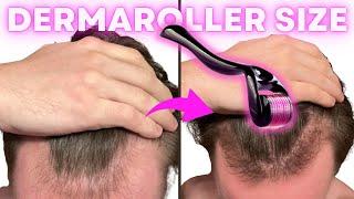 The Best Dermarolling Size for Quickest Hair Growth | with AL GARRIDO