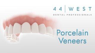 Porcelain Veneers | Grandville Dentist | 44 West Dental Professionals