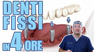 Impianti dentali fissi in 4 ore! Cos'è l' "All on Four"?