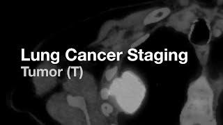 Lung Cancer Staging - Tumor (T)