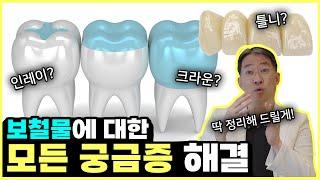 보철물 아래로 치아가 드러났다고? 보철물이 망가졌다고?