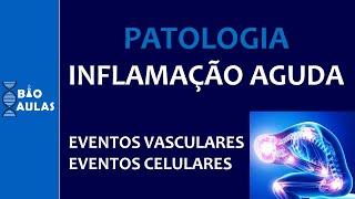 Inflamação Aguda - Eventos Vasculares e Eventos Celulares (Patologia Geral)