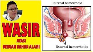 WASIR /AMBEIEN........... GUNAKAN BAHAN-BAHAN ALAMI INI