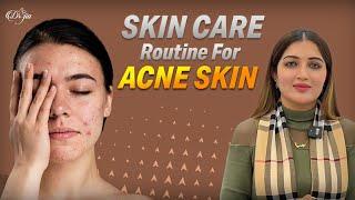 Skin Care Routine For Acne Skin || Acne Treatment || Best dermatologist in UAE  #aesthetic #skincare