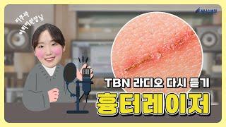 이미 흉터가 생긴 상처는 어떻게 치료 받나요?│ TBN 라디오 다시 듣기