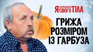 Мужчина прячет паховую грыжу в спортивках 20 лет – Я соромлюсь свого тіла | ВРАЧИ | ЗДОРОВЬЕ