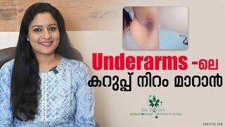 Underarms ലെ കറുപ്പ് നിറം മാറാൻ | How To Lighten Dark Underarms Naturally & Fast | Underarm Darkness