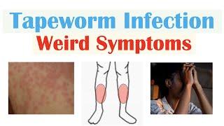 Weird Symptoms of Tapeworm Infection (Skin, Psychological, Neurological)