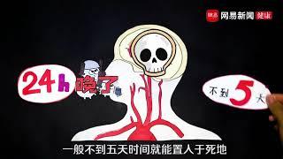 致死率几乎100%，为什么狂犬病这么可怕？ 疫苗 病毒 传染病 免疫系统