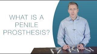 What is a penile prosthesis?