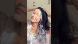 How I treated hairfall & got new hair growth || Indulekha hair oil