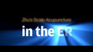 Zhu's Scalp Acupuncture in the ER