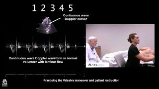 How to Perform Valsalva Maneuver in Patients with HCM