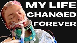 My Traumatic Brain Injury Story | GoForBrandon Accident Documentary