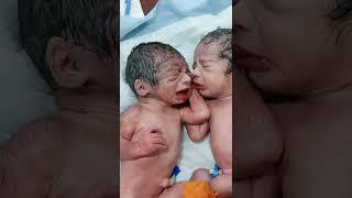 Preterm twins. How one baby sleeps and other tries to awake him with musical first cry #shorts