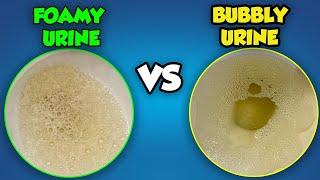 Foamy Urine vs Bubbles in Urine: What is the Difference?