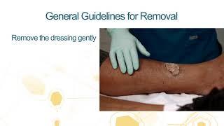 Medihoney Product Guidelines for Removal