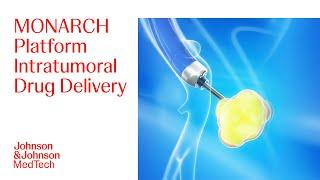 Intratumoral Drug Delivery Animation with MONARCH Platform | J&J MedTech