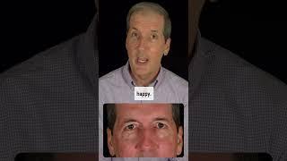 Dr. Green is 8 weeks following quad blepharoplasty with fat grafting and full face CO2