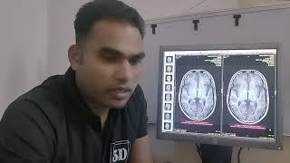 MRI INTERVIEW QUESTIONS MRI BRAIN SEQUENCE