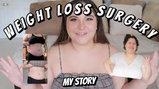 I GOT WEIGHT LOSS SURGERY 2020 | Getting a Gastric Sleeve (VSG) + results after 2 months!