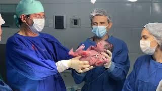 Cesariana/ Caesarean