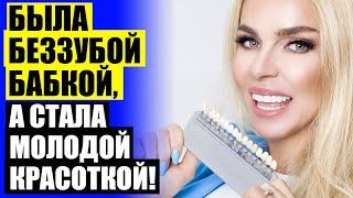 ЦВЕТ ВИНИРОВ B1  ВИНИРЫ SNAP ON SMILE 