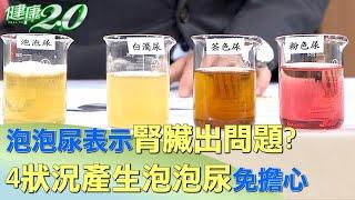 泡泡尿表示腎臟出問題？4狀況產生泡泡尿免擔心 健康2.0