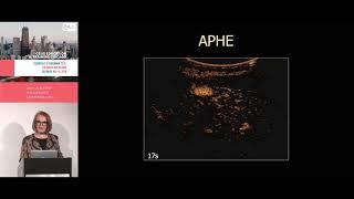 CEUS as compared to CECT and CEMR / HCC imaging and CEUS LI-RADS