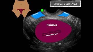 POCUS Female Pelvis Transvaginal Scanning Sequence