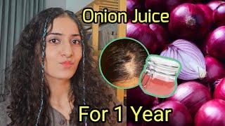 I USED ONION JUICE FOR 1 YEAR! Stop Hairloss & Grow Hair *before and after results*