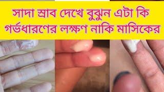 আপনি কী প্রেগন্যান্ট ?পিরিয়ড মিস হওয়ার আগে সাদা স্রাব দেখে বুঝে নিন