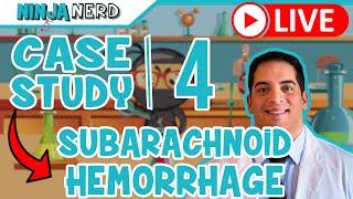 Case Study #4: Subarachnoid Hemorrhage