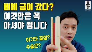 뼈에 금이 갔다고 들으셨다면?