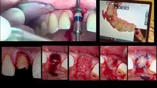 Clinical cases sequence presented by Francisco Teixeira Barbosa